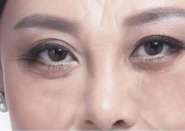 女人有悬针纹代表什么果真克夫克子命不好还是另有含义