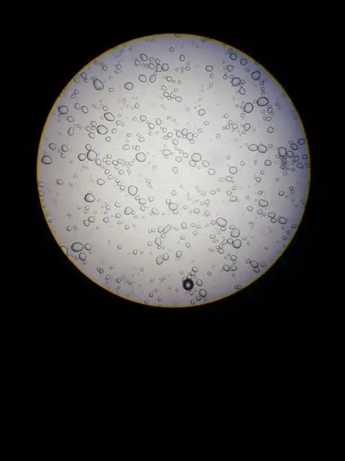 马铃薯里的淀粉颗粒,听说一周4个马铃薯,痛风会下降45%哦