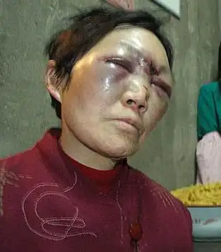 男子将女友母亲打得鼻青脸肿(图)