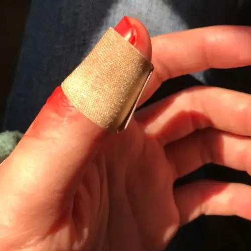 昨天十点左右到小诊所去看,医生给消了下毒贴了个创可贴完事儿,然后打