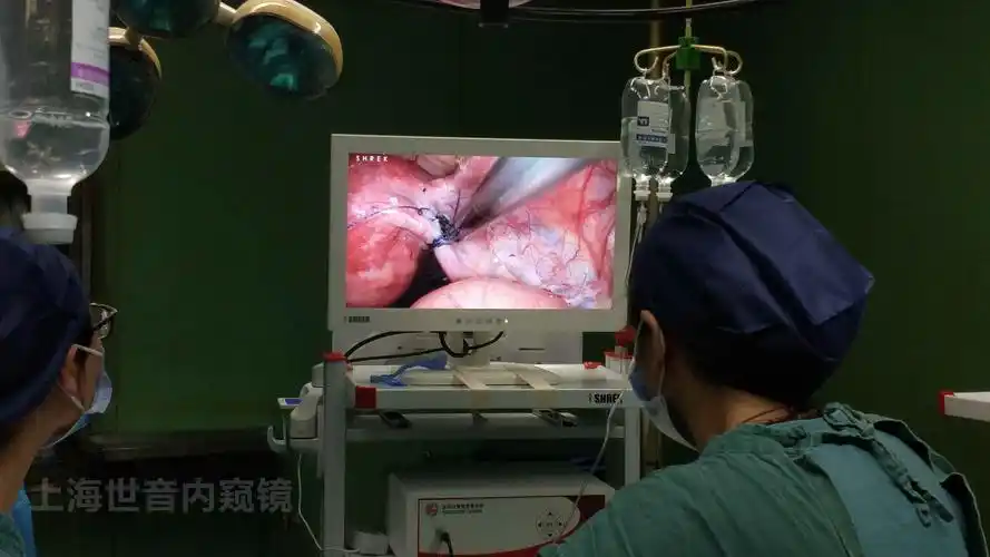 【腹腔镜篇】输卵管妊娠保守手术