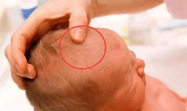 囟门是孩子健康的"晴雨表",透过囟门了解宝宝健康,妈妈要学会