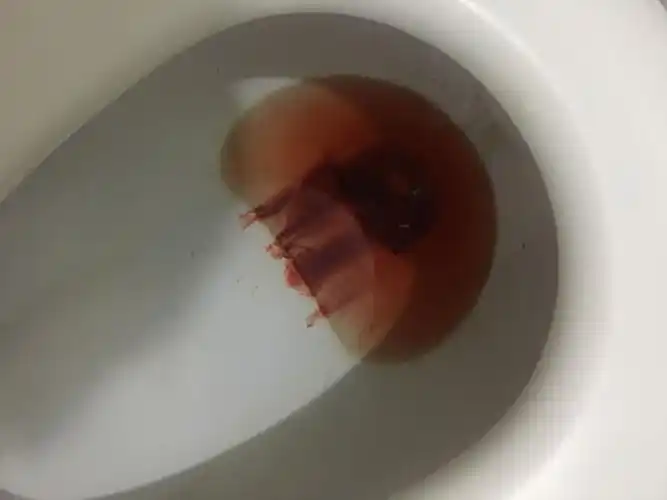 图片是最近一次的,冲水以后还是有血附着在马桶上,冲不下去,求求求求