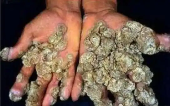 空手指 - 搜狗图片搜索