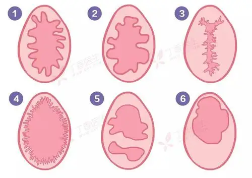 处女与非处女的区别在哪?