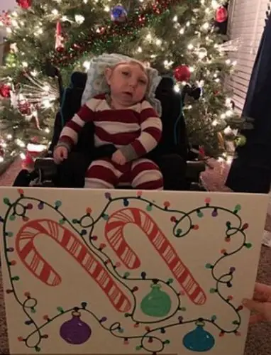 美无脑儿创造生命奇迹圣诞节祝福全世界家庭组图2