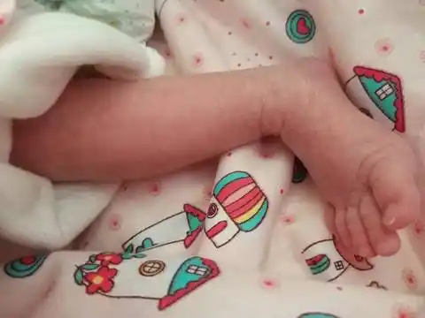 宝宝皮肤有一块一块的网状的类似大理石纹理的_全部回复_宝宝树