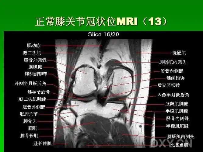 膝关节--mri解剖ppt