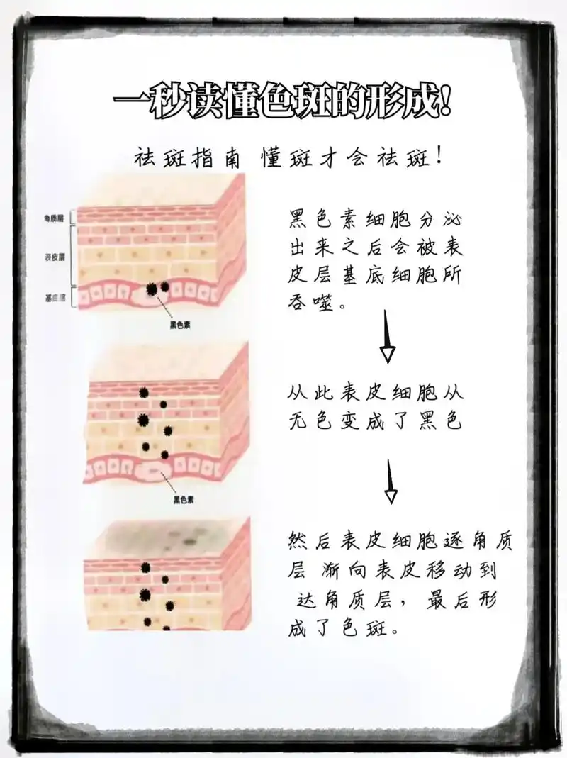 带你认识斑点的形成,教你祛斑的正确方法.十个女人九个斑,有斑 - 抖音