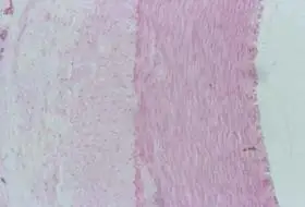 中动脉                中动脉静脉2.