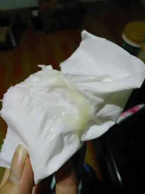 白带多然后是这个颜色的请问是因为什么 生过一个宝宝 现在是一岁半了