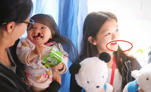 王菲女儿李嫣与唇腭裂孩子玩耍嘴上疤痕明显身上包包仅值百元