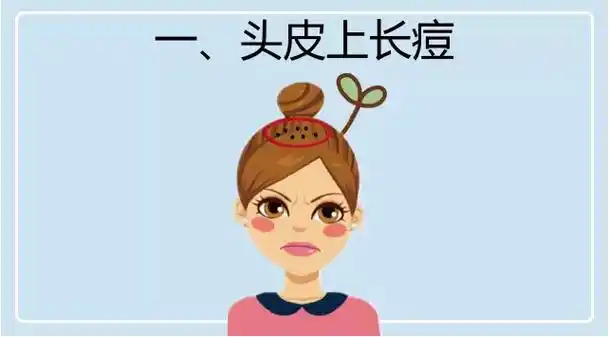 长痘位置能看出啥?反正不是内脏健康 - 微医(挂号网)