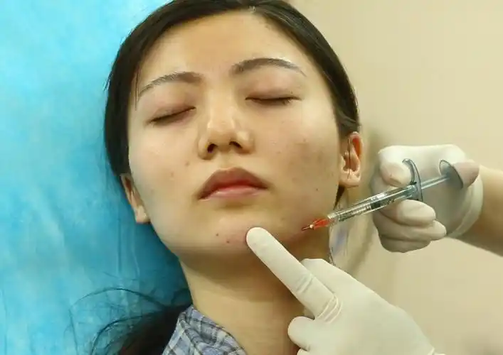 给患者注射瘦脸针