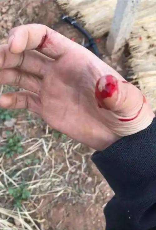 避免蛇到钓点偶遇蛇的处理方法被蛇咬之后的急救措施