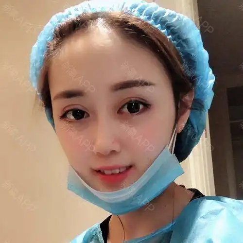 "金鱼眼"可以做双眼皮吗?