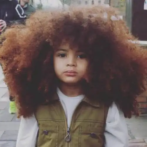 含硫氨基酸丰富的食物(世界上发量最多3个宝宝,像是