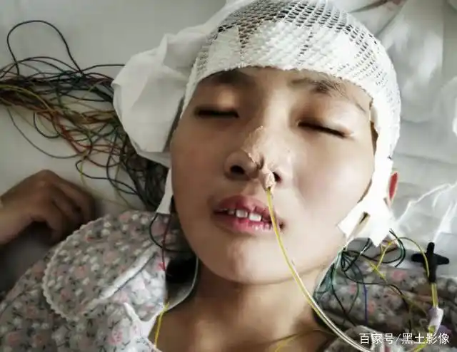 12岁男孩被罕见病毒感染形同植物人,母亲哭诉:我是家里的罪人