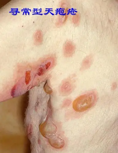 私人医生能为你做点什么?皮肤科②