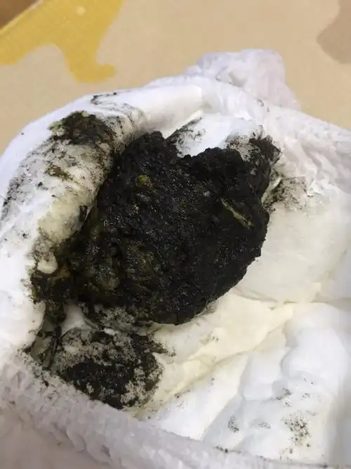 14个月宝宝这两天拉肚子,所以光喂的大米稀饭,但是拉了黑便