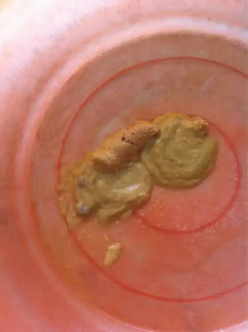 宝宝粑粑是白色正常吗白色大便