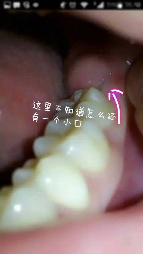 2014-05-25 吴国旺 医师 左下颚淋巴结肿,触摸有疼痛感,最近左侧仰父