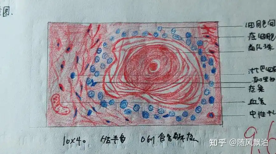 病理切片绘图红蓝铅笔