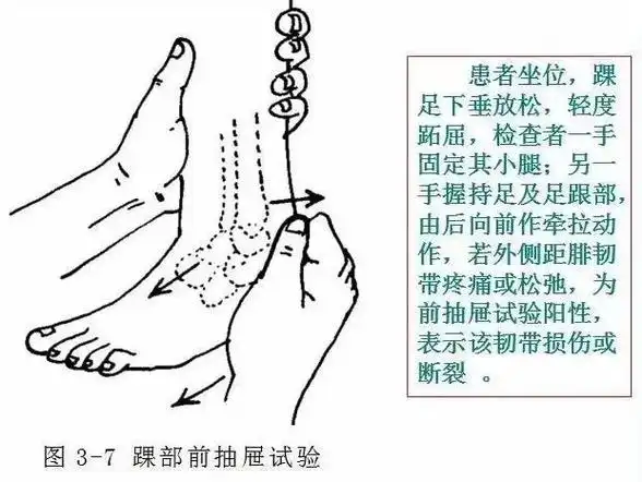 3.踝部前抽屉试验