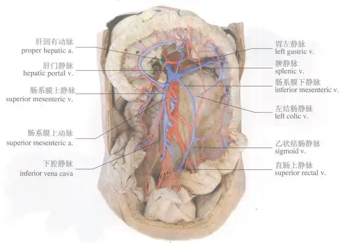 6-85 肝门静脉组成(原位)-人体系统解剖学实物-医学