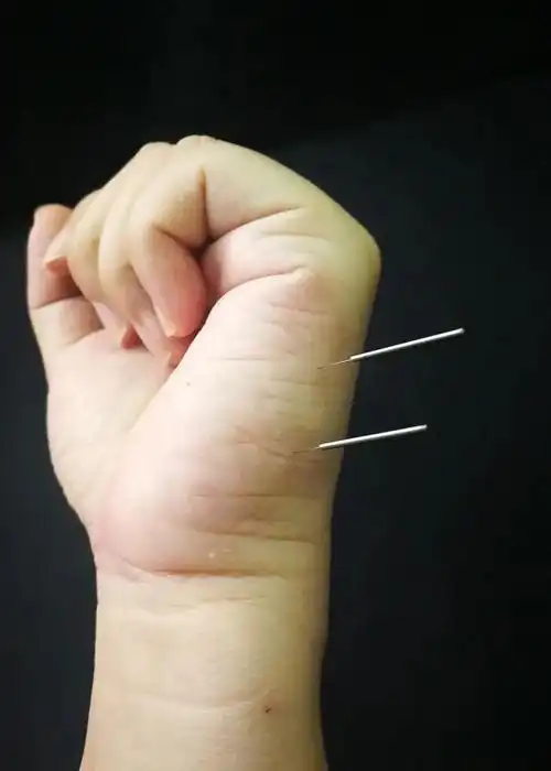 董氏针灸 穴位解读腰灵:腰上的毛病一扎就灵 | 董氏针灸 穴位解吨手