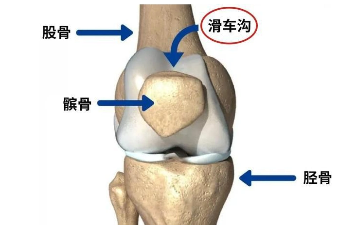 膝关节咔咔作响,上下楼疼痛不适,髌骨软化症到底该如何治疗