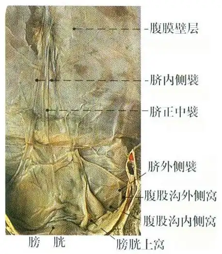 腹前壁腹膜解剖示意图-人体解剖图