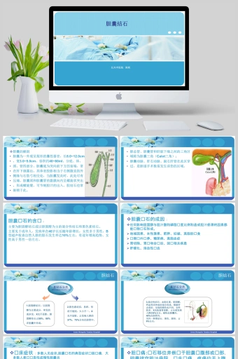 胆囊结石ppt模板