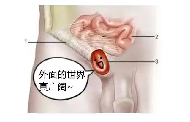 宝宝这病不警惕,会成难以启齿的痛