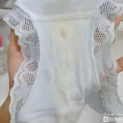 详细讲解!白带什么样说明怀孕了"一往无前"-第2张图片-浩葵网