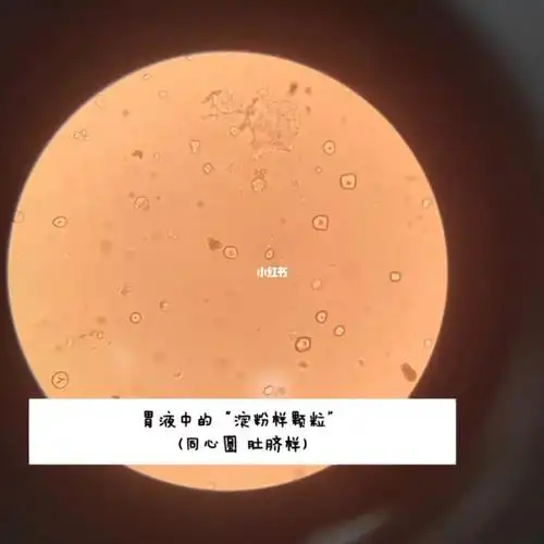 检验科镜检～尿酸结晶,淀粉颗粒5