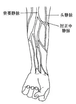 选择注射血管(常用肘窝部贵要静脉,肘正中静脉,头静脉及前臂内侧静脉