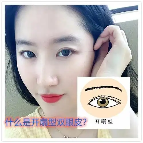开扇型双眼皮的优点有哪些?适合你的脸型吗?