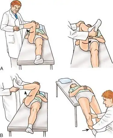 髋关节内收,内旋时引起疼痛.