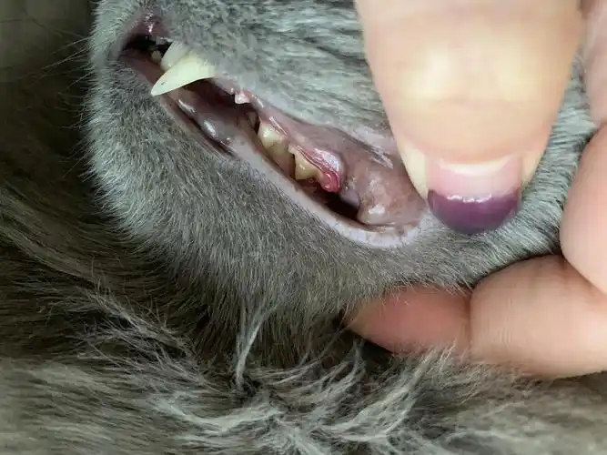 【讨论】牙龈上长了个红色疙瘩是口腔溃疡么?