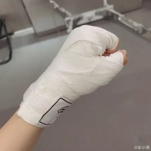 太心疼30岁女星为减肥练拳击双手受伤破皮淤青严重恐留疤