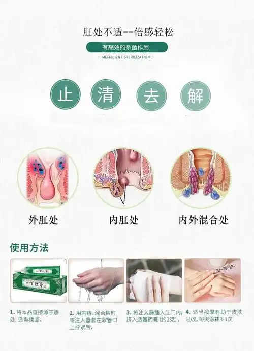 百草堂百致膏痔疮膏正品男女痣疮栓膏肛门内痣外痣混合痣清热舒缓
