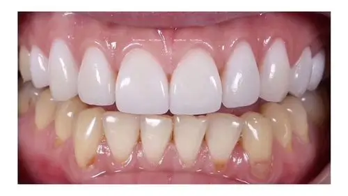 美牙招商加盟美牙品牌加盟