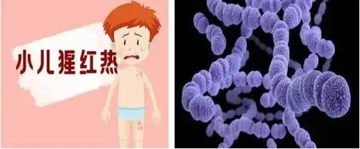 诊断_检测_儿童