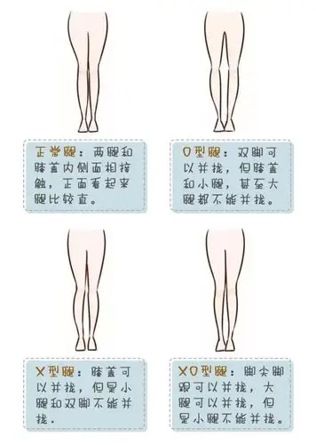 o型腿娱乐圈最明显的要数林允儿