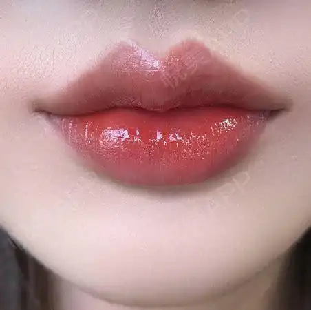 omg,你的唇形也太好看了吧!_悦美整形