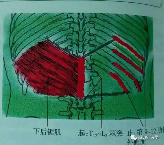 下后锯肌损伤腰痛,两例典型病案分享