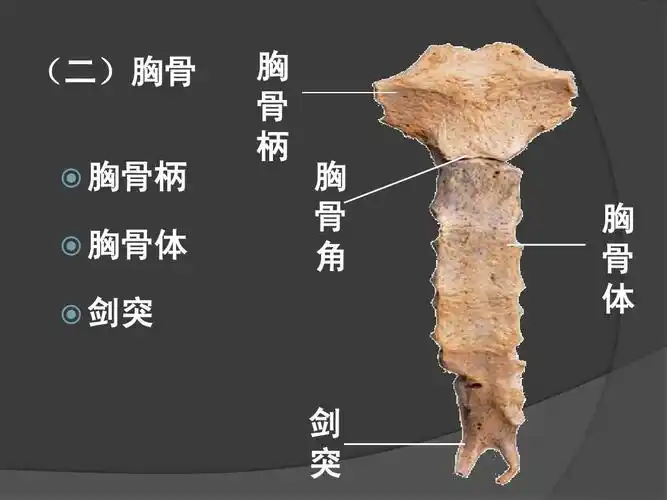 (二)胸骨   胸骨柄   胸骨体 胸 骨 柄 胸 骨 角   剑突 胸 骨 体 剑