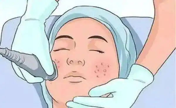 美容变毁容安康一准新娘在西安祛斑后全脸溃烂婚没结成维权也无果