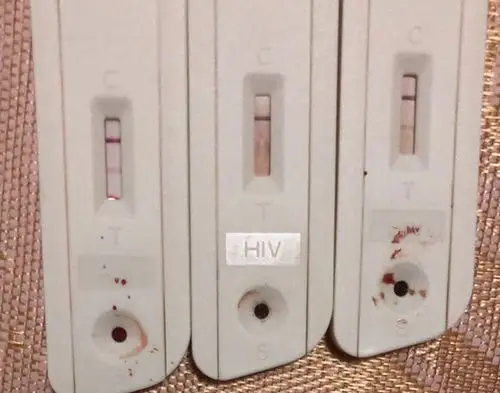 艾滋病试纸半小时后变阳 虚惊一场